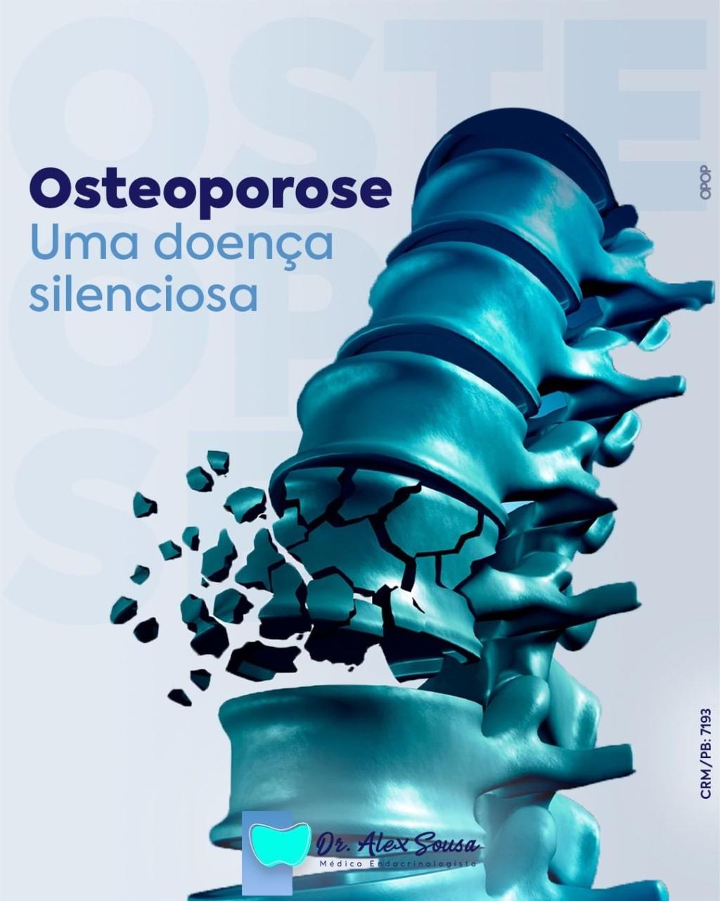 Tratamento Para Osteoporose Em Afogados Da Ingazeira PE